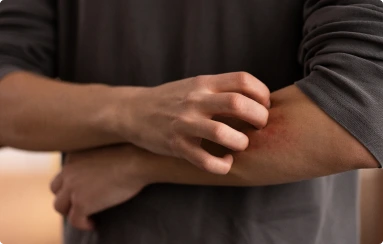 Lanolin Against the Mosquito Bite